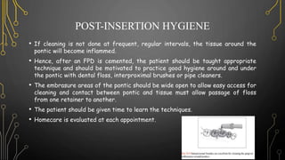 POST-INSERTION HYGIENE
• If cleaning is not done at frequent, regular intervals, the tissue around the
pontic will become inflammed.
• Hence, after an FPD is cemented, the patient should be taught appropriate
technique and should be motivated to practice good hygiene around and under
the pontic with dental floss, interproximal brushes or pipe cleaners.
• The embrasure areas of the pontic should be wide open to allow easy access for
cleaning and contact between pontic and tissue must allow passage of floss
from one retainer to another.
• The patient should be given time to learn the techniques.
• Homecare is evaluated at each appointment.
 