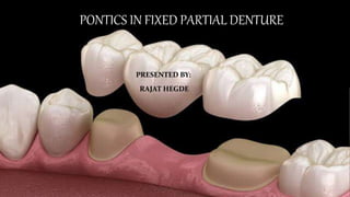 PONTICS IN FIXED PARTIAL DENTURE
PRESENTED BY:
RAJAT HEGDE
 
