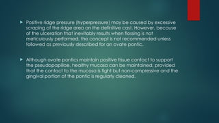 Positive Ridge PONTICS as a part of fixed partial denture | PPTX