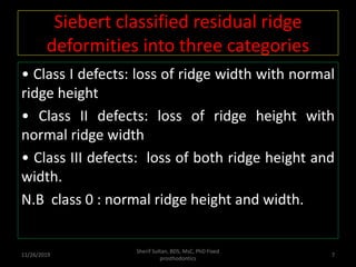 Siberet Ridge Defect Pontics 1 | PPTX