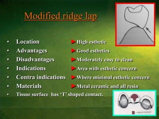 37
Modified ridge lap
• Location ►High esthetic
• Advantages ►Good esthetics
• Disadvantages ►Moderately easy to clean
• Indications ►Area with esthetic concern
• Contra indications ►Where minimal esthetic concern
• Materials ►Metal ceramic and all resin
• Tissue surface has ‘T’ shaped contact.
 