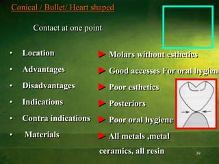 39
Conical / Bullet/ Heart shaped
Contact at one point
• Location
• Advantages
• Disadvantages
• Indications
• Contra indications
• Materials
► Molars without esthetics
► Good accesses For oral hygiene
► Poor esthetics
► Posteriors
► Poor oral hygiene
► All metals ,metal
ceramics, all resin
 