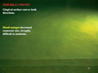 43
FISH BELLY PONTIC
Gingival surface convex both
directions.
Disadvantages-decreased
connector size, strength,
difficult to maintain.
 