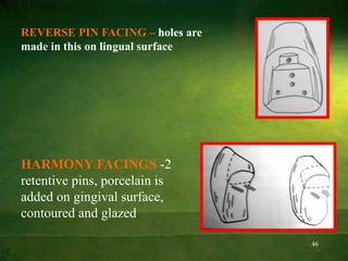46
REVERSE PIN FACING – holes are
made in this on lingual surface
HARMONY FACINGS -2
retentive pins, porcelain is
added on gingival surface,
contoured and glazed.
 