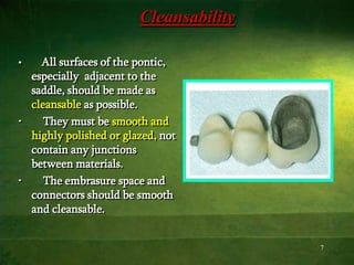 7
Cleansability
• All surfaces of the pontic,
especially adjacent to the
saddle, should be made as
cleansable as possible.
• They must be smooth and
highly polished or glazed, not
contain any junctions
between materials.
• The embrasure space and
connectors should be smooth
and cleansable.
 