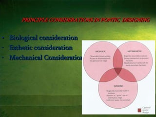 9
PRINCIPLE CONSIDERATIONS IN PONTIC DESIGNING
• Biological consideration
• Esthetic consideration
• Mechanical Consideration
 