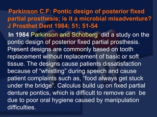 Parkinson C.F: Pontic design of posterior fixed
partial prosthesis; is it a microbial misadventure?
J Prosthet Dent 1984; 51; 51-54
In 1984 Parkinson and Schoberg did a study on the
pontic design of posterior fixed partial prosthesis.
Present designs are commonly based on tooth
replacement without replacement of basic or soft
tissue. The designs cause patients dissatisfaction
because of “whistling” during speech and cause
patient complaints such as, “food always get stuck
under the bridge”. Calculus build up on fixed partial
denture pontics, which is difficult to remove can be
due to poor oral hygiene caused by manipulation
difficulties.
 