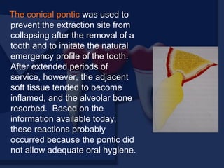 The conical pontic was used to
prevent the extraction site from
collapsing after the removal of a
tooth and to imitate the natural
emergency profile of the tooth.
After extended periods of
service, however, the adjacent
soft tissue tended to become
inflamed, and the alveolar bone
resorbed. Based on the
information available today,
these reactions probably
occurred because the pontic did
not allow adequate oral hygiene.
 