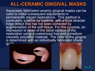 Separately fabricated ceramic gingival masks can be
used to make subsequent adjustments in
permanently placed restorations. This method is
particularly suitable for patients with a local alveolar
ridge defect that has not been corrected by
augmentation of the soft tissue. For this purpose, an
impression is taken of the labial surface of the
restoration using a customized tray and a medium
viscosity polyether material. The color of the gingiva
is determined with an individually fabricated shade
guide.
ALL-CERAMIC GINGIVAL MASKS
BACK
 