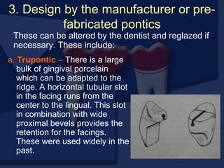 3. Design by the manufacturer or pre-
fabricated pontics
a. Trupontic – There is a large
bulk of gingival porcelain
which can be adapted to the
ridge. A horizontal tubular slot
in the facing runs from the
center to the lingual. This slot
in combination with wide
proximal bevels provides the
retention for the facings.
These were used widely in the
past.
These can be altered by the dentist and reglazed if
necessary. These include:
 