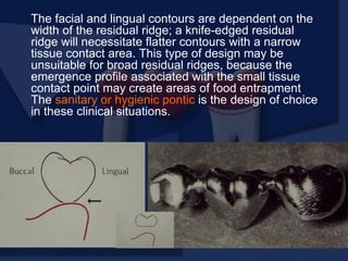 The facial and lingual contours are dependent on the
width of the residual ridge; a knife-edged residual
ridge will necessitate flatter contours with a narrow
tissue contact area. This type of design may be
unsuitable for broad residual ridges, because the
emergence profile associated with the small tissue
contact point may create areas of food entrapment
The sanitary or hygienic pontic is the design of choice
in these clinical situations.
 