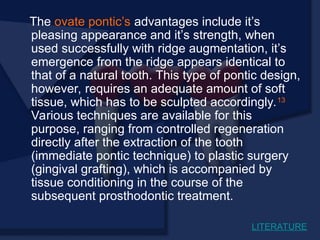 The ovate pontic’s advantages include it’s
pleasing appearance and it’s strength, when
used successfully with ridge augmentation, it’s
emergence from the ridge appears identical to
that of a natural tooth. This type of pontic design,
however, requires an adequate amount of soft
tissue, which has to be sculpted accordingly.13
Various techniques are available for this
purpose, ranging from controlled regeneration
directly after the extraction of the tooth
(immediate pontic technique) to plastic surgery
(gingival grafting), which is accompanied by
tissue conditioning in the course of the
subsequent prosthodontic treatment.
LITERATURE
 