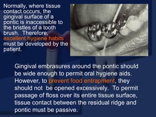 Normally, where tissue
contact occurs, the
gingival surface of a
pontic is inaccessible to
the bristles of a tooth
brush. Therefore,
excellent hygiene habits
must be developed by the
patient.
Gingival embrasures around the pontic should
be wide enough to permit oral hygiene aids.
However, to prevent food entrapment, they
should not be opened excessively. To permit
passage of floss over its entire tissue surface,
tissue contact between the residual ridge and
pontic must be passive.
 
