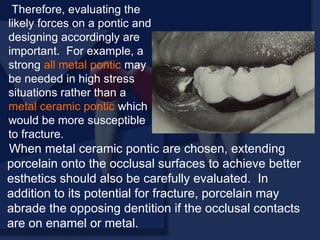 When metal ceramic pontic are chosen, extending
porcelain onto the occlusal surfaces to achieve better
esthetics should also be carefully evaluated. In
addition to its potential for fracture, porcelain may
abrade the opposing dentition if the occlusal contacts
are on enamel or metal.
Therefore, evaluating the
likely forces on a pontic and
designing accordingly are
important. For example, a
strong all metal pontic may
be needed in high stress
situations rather than a
metal ceramic pontic which
would be more susceptible
to fracture.
 