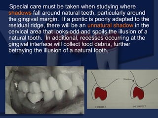 Special care must be taken when studying where
shadows fall around natural teeth, particularly around
the gingival margin. If a pontic is poorly adapted to the
residual ridge, there will be an unnatural shadow in the
cervical area that looks odd and spoils the illusion of a
natural tooth. In additional, recesses occurring at the
gingival interface will collect food debris, further
betraying the illusion of a natural tooth.
 