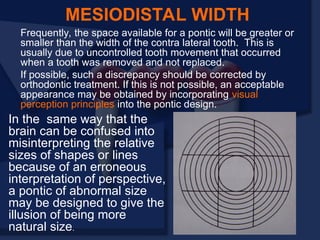 Frequently, the space available for a pontic will be greater or
smaller than the width of the contra lateral tooth. This is
usually due to uncontrolled tooth movement that occurred
when a tooth was removed and not replaced.
If possible, such a discrepancy should be corrected by
orthodontic treatment. If this is not possible, an acceptable
appearance may be obtained by incorporating visual
perception principles into the pontic design.
MESIODISTAL WIDTH
In the same way that the
brain can be confused into
misinterpreting the relative
sizes of shapes or lines
because of an erroneous
interpretation of perspective,
a pontic of abnormal size
may be designed to give the
illusion of being more
natural size.
 