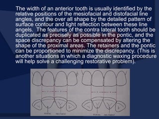 The width of an anterior tooth is usually identified by the
relative positions of the mesiofacial and distofacial line
angles, and the over all shape by the detailed pattern of
surface contour and light reflection between these line
angels. The features of the contra lateral tooth should be
duplicated as precisely as possible in the pontic, and the
space discrepancy can be compensated by altering the
shape of the proximal areas. The retainers and the pontic
can be proportioned to minimize the discrepancy. (This is
another situations in which a diagnostic waxing procedure
will help solve a challenging restorative problem).
 
