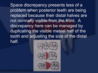 Space discrepancy presents less of a
problem when posterior teeth are being
replaced because their distal halves are
not normally visible from the front. A
discrepancy here can be managed by
duplicating the visible mesial half of the
tooth and adjusting the size of the distal
half.
 