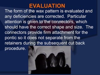 The form of the wax pattern is evaluated and
any deficiencies are corrected. Particular
attention is given to the connectors, which
should have the correct shape and size. The
connectors provide firm attachment for the
pontic so it does not separate from the
retainers during the subsequent cut back
procedure.
EVALUATION
 