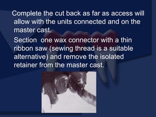 Complete the cut back as far as access will
allow with the units connected and on the
master cast.
Section one wax connector with a thin
ribbon saw (sewing thread is a suitable
alternative) and remove the isolated
retainer from the master cast.
 