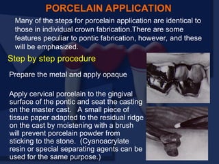 Prepare the metal and apply opaque
Apply cervical porcelain to the gingival
surface of the pontic and seat the casting
on the master cast. A small piece of
tissue paper adapted to the residual ridge
on the cast by moistening with a brush
will prevent porcelain powder from
sticking to the stone. (Cyanoacrylate
resin or special separating agents can be
used for the same purpose.)
PORCELAIN APPLICATION
Many of the steps for porcelain application are identical to
those in individual crown fabrication.There are some
features peculiar to pontic fabrication, however, and these
will be emphasized.
Step by step procedure
 