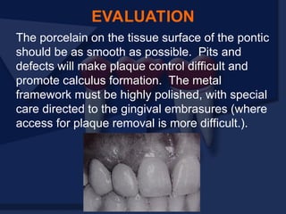EVALUATION
The porcelain on the tissue surface of the pontic
should be as smooth as possible. Pits and
defects will make plaque control difficult and
promote calculus formation. The metal
framework must be highly polished, with special
care directed to the gingival embrasures (where
access for plaque removal is more difficult.).
 