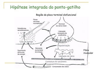 Hipótese integrada do ponto-gatilho
                          Região da placa terminal disfuncional
                      Fibras
                      nervosas
                      nociceptivas              Terminal
                                             do nervo motor
   Substâncias
   sensibilizadoras
                                                Liberação
                                               excessiva de
                                                acetilcolina




                        Demanda
   Suprimento           aumentada                                 Fibra
   diminuído            de energia
   de energia
                                                                  muscular




                                         Compressão dos vasos
 