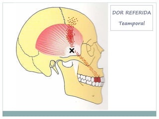 DOR REFERIDA

 Teamporal
 