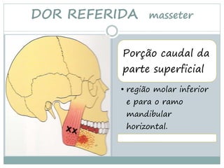 DOR REFERIDA     masseter


          Porção caudal da
          parte superficial
          • região molar inferior
           e para o ramo
           mandibular
           horizontal.
 