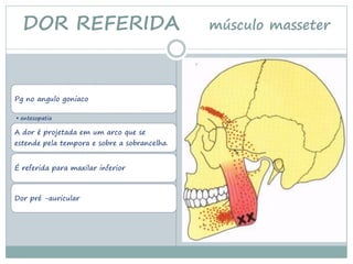 DOR REFERIDA                                músculo masseter




Pg no angulo goniaco

• entesopatia

A dor é projetada em um arco que se
estende pela tempora e sobre a sobrancelha.


É referida para maxilar inferior



Dor pré -auricular
 