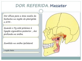 DOR REFERIDA Masseter

Dor difusa para a área media da
bochecha na região do pterigóide
e ATM .


Quando o Pg está próximo à
ligação zigomática posterior _ dor
profunda na orelha.



Zumbido na orelha ipsilateral


• rugido baixo
 