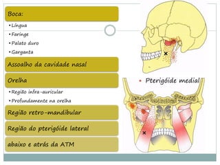 Boca:
• Língua
• Faringe
• Palato duro
• Garganta

Assoalho da cavidade nasal

Orelha                          Pterigóide medial

• Região infra-auricular
• Profundamente na orelha

Região retro-mandibular

Região do pterigóide lateral

abaixo e atrás da ATM
 