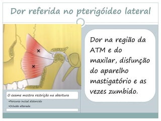 Dor referida no pterigóideo lateral


                                       Dor na região da
                                       ATM e do
                                       maxilar, disfunção
                                       do aparelho
                                       mastigatório e as

O exame mostra restrição na abertura
                                       vezes zumbido.
•Percurso incisal distorcido
•Oclusão alterada
 