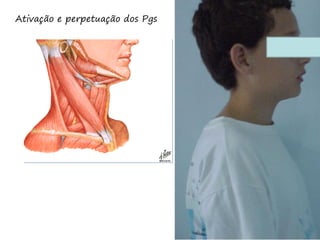 Ativação e perpetuação dos Pgs
 