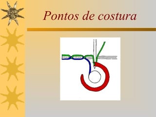 Pontos de costura
 