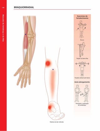 Músculos
do
Antebraço
e
da
M
ão
138 BRAQUIORRADIAL
Padráo do dor referida
 