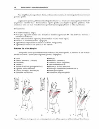 48 Pontos-Gatilho - Uma Abordagem Concisa
Para simplificar, desse ponto em diante, serão descritos o exame do músculo peitoral maior e seu(s)
ponto(s)-gatilho.
Os principais pontos-gatilho do músculo peitoral maior são observados em sua parte clavicular. O
pinçamento é o melhor modo de se examinar o ponto-gatilho nessa região. Os pontos-gatilho na parte
anterior do tórax são mais bem observados por meio de uma palpação com as mãos espalmadas.
Procedimento:
• Paciente sentado ou em pé;
• Pedir para o paciente realizar uma abdução do membro superior em 90" a fim de levar o músculo a
uma tensão moderada;
• Palpar a fim de verificar a presença de um nódulo ou uma banda rígida;
• Observar se ocorrem espasmos ã palpação;
• A pressão deve reproduzir os sintomas relatados pelo paciente;
• A pressão deve induzir um padrão de dor referida.
Fatores de Manutenção
Os seguintes fatores possibilitam uma manutenção dos pontos-gatilho. A presença de um ou mais
fatores dificultam a eliminação dos pontos-gatilho a longo prazo.
• Idade; • Doenças;
• Postura (incluindo a laborai); • Deficiência vitamínica;
• Obesidade; • Anomalias ósseas congênitas;
• Anorexia; • Tipo de fibra muscular;
• Tecidos cicatriciais (pós-operatórios); • Orientação da fibra muscular;
• Esportes, hobbiese hábitos; • Morfologia do músculo (fusiforme, etc.);
• Padrões de carga e deformação; • Fatores psicológicos;
• Distúrbios metabólicos; • Cronicidade do ponto-gatilho.
Figura 3.7: Técnicas de alongamento para o músculo peitoral maior; a) fibras superiores, b) fibras médias, c) fibras inferiores.
 