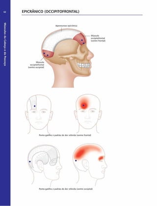 Músculos
da
Cabeça
e
do
Pescoço
62 EPICRÂNICO (OCCIPITOFRONTAL)
Músculo
occipitofrontal
(ventre occipital)
Aponeurose epicrãnica
Músculo
occipitofrontal
(ventre frontal)
Ponto-gatilho e padrão de dor referida (ventre frontal)
Ponto-gatilho e padrão de dor referida (ventre occipital)
 
