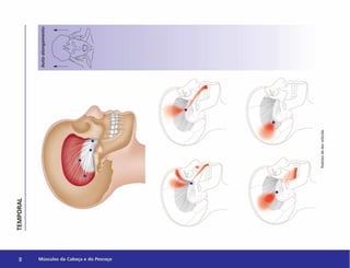 s Músculos da Cabeça e do Pescoço
Padrões
d
e
dor
referida
 