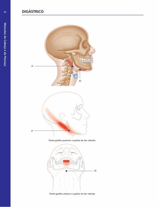 Músculos
da
Cabeça
e
do
Pescoço
74 DIGÁSTRICO
a)
a)
Ponto-gatilho posterior e padrão de dor referida
b)
Ponto-gatilho anterior e padrão de dor referida
 