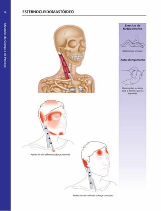 Músculos
da
Cabeça
e
do
Pescoço
78 ESTERNOCLEIDOMASTÓIDEO
Exercício de
fortalecim ento
Abdominais (sit-ups)
Auto-alongam ento
Movimentar a cabeça
para a direita e para a
esquerda.
Padrão de dor referida (cabeça clavicular)
 