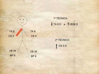IG P FONTE LO 3º TÉCNICA:  LO DE P  e  FONTE DE  IG 4º TÉCNICA:  LO IG  e  FONTE DE  P VB 39 BP 6 TA 8 CS 5 TA 8 CS 5 VB 39 BP 6 1º TÉCNICA: TA 8 D  e  VB39 D 2º TÉCNICA: CS 5 D 