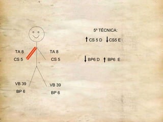 IG P FONTE LO 3º TÉCNICA:  LO DE P  e  FONTE DE  IG 4º TÉCNICA:  LO IG  e  FONTE DE  P VB 39 BP 6 TA 8 CS 5 TA 8 CS 5 VB 39 BP 6 5º TÉCNICA: CS 5 D  CS5 E  BP6 D  BP6  E 