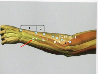 3 2 IG 11 IG 9 IG 7 2 IG 6 IG 10 
