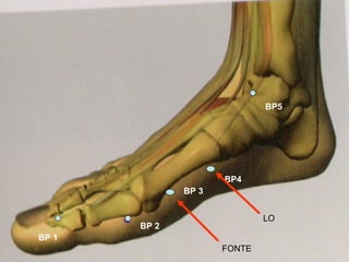BP 1 BP 2 BP 3 BP4 BP5 LO FONTE 