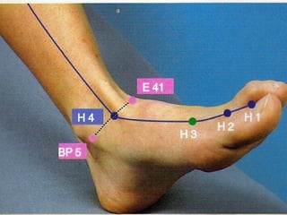 IG P FONTE LO 3º TÉCNICA:  LO DE P  e  FONTE DE  IG 4º TÉCNICA:  LO IG  e  FONTE DE  P 