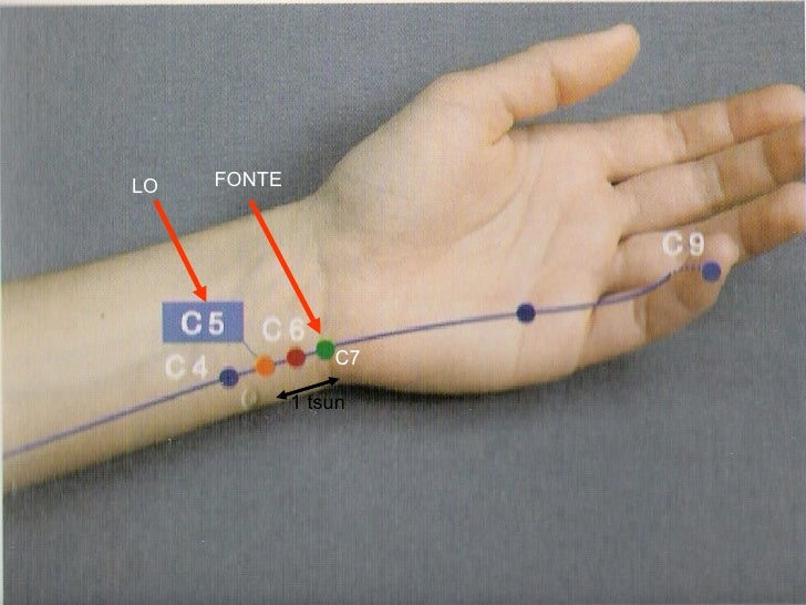 Resultado de imagem para ponto acupuntura c7