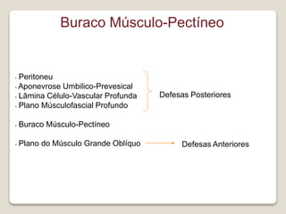 Buraco Músculo-Pectíneo
• Peritoneu
• Aponevrose Umbilico-Prevesical
• Lâmina Célulo-Vascular Profunda
• Plano Músculofasc...