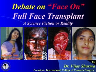 Debate on “Face On”
Full Face Transplant
A Science Fiction or Reality
by
Dr. Vijay Sharma
President - International Colleg...