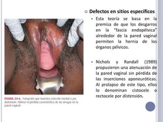  Defectos en sitios específicos
 Esta teoría se basa en la
premisa de que los desgarros
en la “fascia endopélvica”
alrededor de la pared vaginal
permiten la hernia de los
órganos pélvicos.
 Nichols y Randall (1989)
propusieron una atenuación de
la pared vaginal sin pérdida de
las inserciones aponeuróticas.
Al prolapso de este tipo, ellos
lo denominan cistocele o
rectocele por distensión.
 
